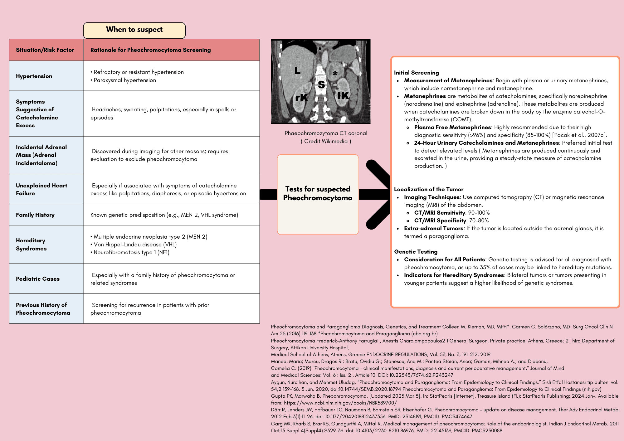 Pheochromocytoma